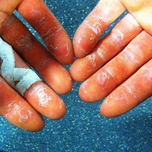 Rock Climbers: How to Care for Your Fingers + Hands