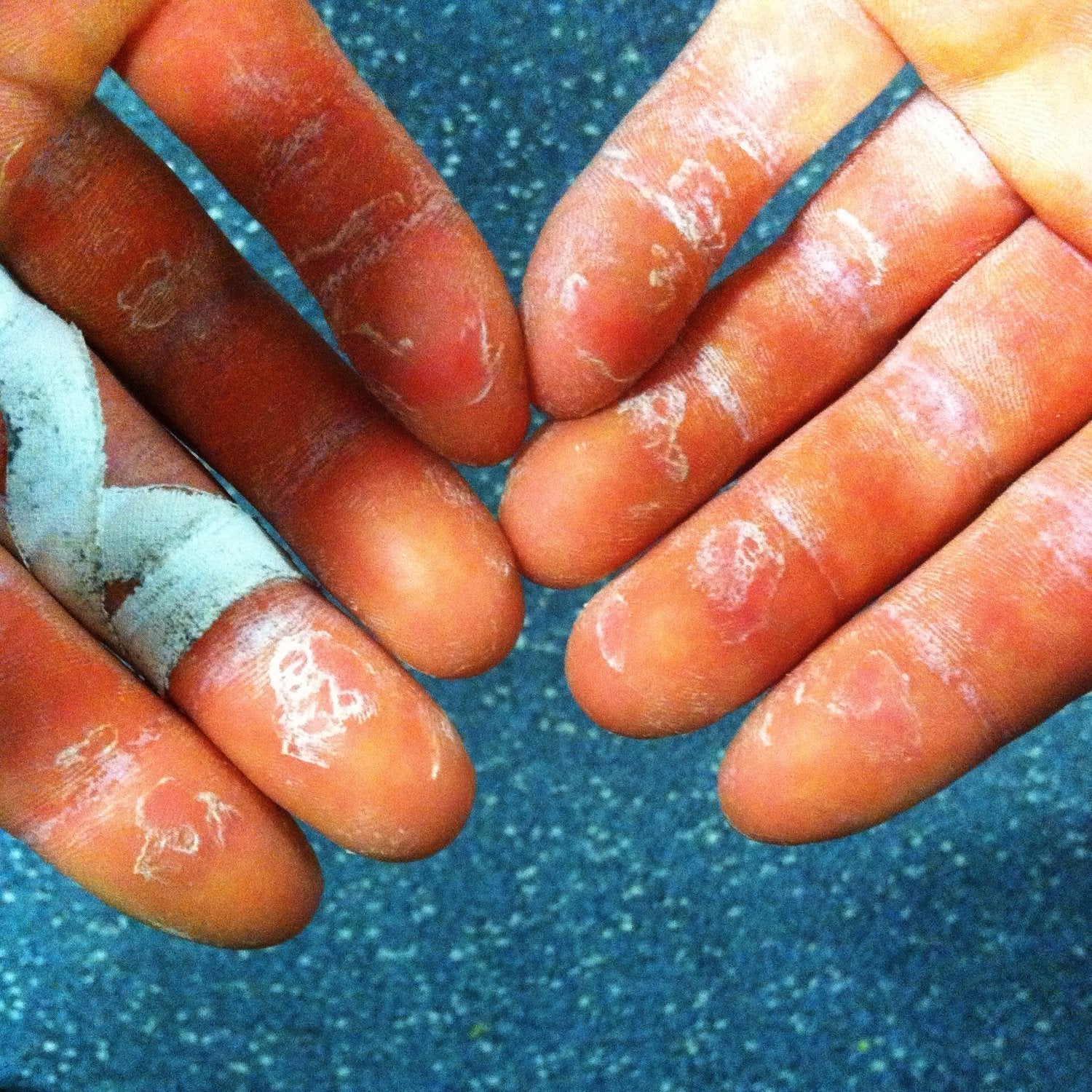 rock climbers hands with powder and tape on them